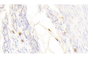 Detection of TPS in Canine Oviduct Tissue using Polyclonal Antibody to Tryptase (TPS)