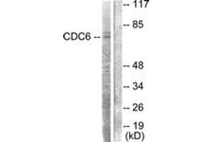 Western Blotting (WB) image for anti-Cell Division Cycle 6 Homolog (S. Cerevisiae) (CDC6) (AA 20-69) antibody (ABIN2888619) (CDC6 anticorps  (AA 20-69))