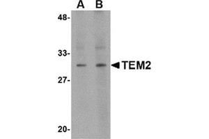 Western blot analysis of TEM2 in human colon tissue lysate with this product at (A) 1 and (B) 2 μg/ml.