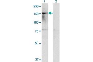 Western Blot analysis of HDAC6 expression in transfected 293T cell line by HDAC6 monoclonal antibody (M01), clone 1E2. (HDAC6 anticorps  (AA 1128-1215))