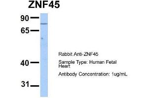 Host:  Rabbit  Target Name:  ZNF45  Sample Type:  Human Fetal Heart  Antibody Dilution:  1. (ZNF45 anticorps  (N-Term))