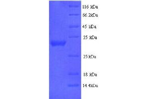 SDS-PAGE (SDS) image for delta-Like 2 Homolog (DLK2) (AA 27-306), (Extracellular) protein (His tag) (ABIN5714388)