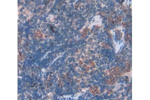 Used in DAB staining on fromalin fixed paraffin- embedded Kidney tissue (BAFF anticorps  (AA 21-169))