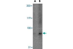 Western blot analysis of TMC6 in A-20 cell lysate with TMC6 polyclonal antibody  at (A) 1 and (B) 2 ug/mL . (TMC6 anticorps  (N-Term))