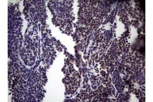 Image no. 19 for anti-Nibrin (NBN) (AA 183-460) antibody (ABIN1491066)