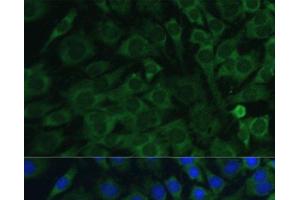 Immunofluorescence analysis of C6 cells using OSM Polyclonal Antibody at dilution of 1:100. (Oncostatin M anticorps)