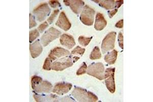 Immunohistochemistry analysis in formalin fixed and paraffin embedded skeletal muscle reacted with LFNG Antibody (Center) followed by peroxidase conjugation of the secondary antibody and DAB staining. (LFNG anticorps  (Middle Region))