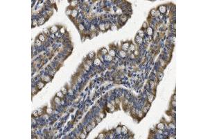 IHC analysis of REA/PHB2 using anti REA/PHB2 antibody (ABIN7599240).