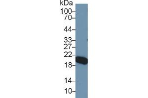 Detection of APOM in Mouse Serum using Polyclonal Antibody to Apolipoprotein M (APOM)