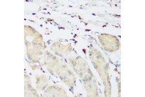 Immunohistochemistry of paraffin-embedded human stomach using PLEK antibody (ABIN6290796) at dilution of 1:200 (40x lens). (Pleckstrin anticorps)