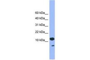 Image no. 1 for anti-Cell Division Cycle 26 Homolog (CDC26) (C-Term) antibody (ABIN6745280) (CDC26 anticorps  (C-Term))