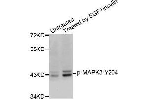 Western blot analysis of extracts from SK-BR-3 cells, using Phospho-MAPK3-Y204 antibody. (ERK1 anticorps  (pTyr204))