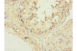 Immunohistochemistry of paraffin-embedded human testis tissue using ABIN7159966 at dilution of 1:100 (MFN1 anticorps  (AA 622-741))