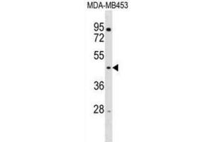 Western Blotting (WB) image for anti-Ring Finger Protein 128 (RNF128) antibody (ABIN3000884)