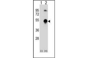 Western blot analysis of GATA3 (arrow) using GATA3 Antibody (Center) Cat. (GATA3 anticorps  (Middle Region))