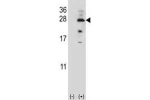 Western blot analysis of IL17B antibody and 293 cell lysate (2 ug/lane) either nontransfected (Lane 1) or transiently transfected (2) with the IL17B gene. (IL17B anticorps  (AA 39-66))