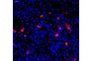 Immunofluorescence of paraffin embedded human subcutaneous transplant tumor(SW480) using c-caspase3 (ABIN7073336) at dilution of 1:1200 (400x lens)