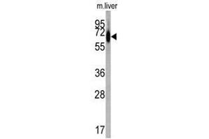 Image no. 1 for anti-Albumin (ALB) (C-Term) antibody (ABIN452731) (Albumin anticorps  (C-Term))