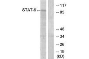 Western blot analysis of extracts from HeLa cells, using STAT6 (Ab-641) Antibody. (STAT6 anticorps  (AA 608-657))