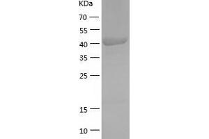 Western Blotting (WB) image for Vesicle Amine Transport 1 (VAT1) (AA 1-393) protein (His-IF2DI Tag) (ABIN7125708)