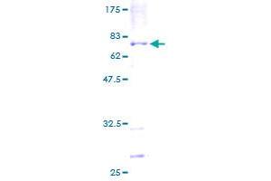 Image no. 1 for Polymerase (DNA Directed), eta (POLH) (AA 1-414) protein (GST tag) (ABIN1315646)