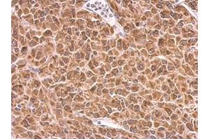 IHC-P Image PRKCSH antibody detects PRKCSH protein at cytosol on U87 xenograft by immunohistochemical analysis. (PRKCSH anticorps)