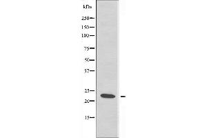 Western blot analysis of extracts from JurKat cells using RPS7 antibody. (RPS7 anticorps  (C-Term))