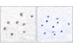 Immunohistochemistry analysis of paraffin-embedded human brain, using Tyrosine Hydroxylase (Phospho-Ser31) Antibody.