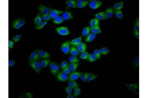 Immunofluorescence staining of Hela cells with ABIN7153647 at 1:133, counter-stained with DAPI. (Gasdermin A anticorps  (AA 64-172))