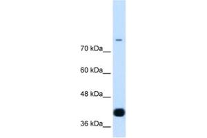 Western Blotting (WB) image for anti-MDS1 and EVI1 Complex Locus (MECOM) antibody (ABIN2460268)