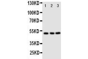 Anti-CXCR4 antibody, Western blotting Lane 1: M231 Cell Lysate Lane 2: MCF-7 Cell Lysate Lane 3: JURKAT Cell Lysate (CXCR4 anticorps  (N-Term))