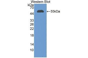 Detection of Recombinant CFI, Human using Polyclonal Antibody to Complement Factor I (CFI)