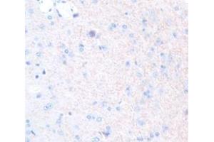 IHC-P analysis of Rat Tissue, with DAB staining. (LHB anticorps  (AA 21-141))