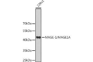 Western blot analysis of extracts of 22Rv1 cells, using MAGE-1/MA antibody (ABIN6132325, ABIN6143435, ABIN6143436 and ABIN6221133) at 1:1000 dilution. (MAGEA1 anticorps  (AA 1-309))