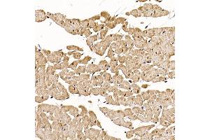 Immunohistochemistry of paraffin-embedded rat heart using RC Rabbit pAb (ABIN6129452, ABIN6146811, ABIN6146812 and ABIN6220955) at dilution of 1:150 (40x lens). (RCAN1 anticorps  (AA 60-245))