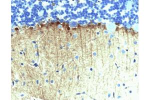 Immunohistochemical staining on rat cerebellum, formalin-fixed paraffin embedded tissue, with citrate pre-treatment (40X magnification). (ENAH anticorps  (AA 415-541))