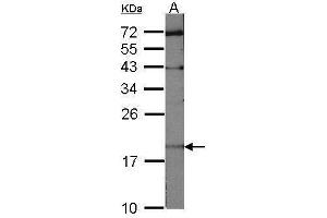 WB Image Sample (30 ug of whole cell lysate) A:NIH-3T3 12% SDS PAGE antibody diluted at 1:1000 (UBE2C anticorps)