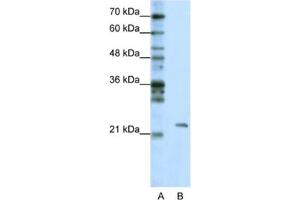 Western Blotting (WB) image for anti-Mitochondrial rRNA Methyltransferase 1 Homolog (MRM1) antibody (ABIN2462305) (MRM1 anticorps)