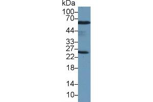 Western blot analysis of Rat Testis lysate, using Human PRDX6 Antibody (2 µg/ml) and HRP-conjugated Goat Anti-Rabbit antibody (