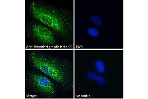 (ABIN238569) Immunofluorescence analysis of paraformaldehyde fixed U2OS cells, permeabilized with 0.