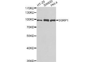 Western blot analysis of extracts of various cell lines, using SSRP1 antibody (ABIN2560151) at 1:1000 dilution. (SSRP1 anticorps)