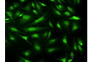 Immunofluorescence of monoclonal antibody to CALML3 on HeLa cell. (CALML3 anticorps  (AA 1-149))