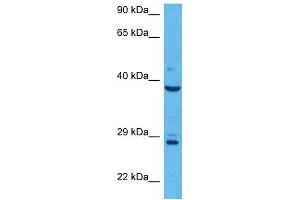 Host:  Rabbit  Target Name:  AGER  Sample Tissue:  Human MCF7 Whole Cell  Antibody Dilution:  1ug/ml (RAGE anticorps  (N-Term))
