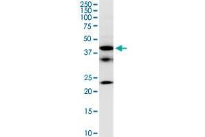 FCRLB monoclonal antibody (M01), clone 2F8. (FCRLB anticorps  (AA 89-174))