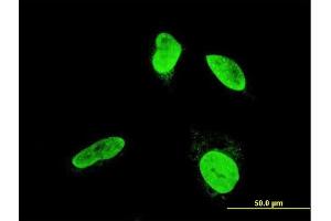 Immunofluorescence of monoclonal antibody to TESK2 on HeLa cell.
