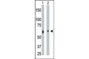 The anti-CERK Pab is used in Western blot to detect CERK in mouse heart tissue lysate (Lane 1) and A2058 cell lysate (Lane 2). (CERK anticorps  (C-Term))