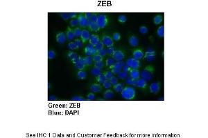 Sample Type :  Human Capan1 cells (Pancreatic cancer cell line)  Primary Antibody Dilution :  1:300  Secondary Antibody :   Anti-rabbit-AlexaFluor-488  Secondary Antibody Dilution :  1:200  Color/Signal Descriptions :  ZEB: Green DAPI: Blue  Gene Name :  ZEB1  Submitted by :  Dr. (ZEB1 anticorps  (N-Term))