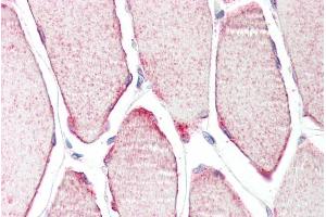 anti-Tripartite Motif Containing 54 (TRIM54) (C-Term) antibody