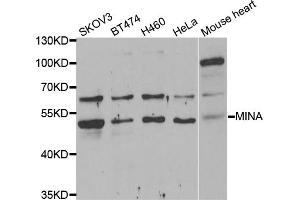 Western blot analysis of extracts of various cell lines, using MINA antibody (ABIN5974006) at 1/1000 dilution. (MINA anticorps)