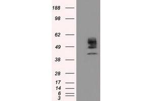 Image no. 3 for anti-Cytochrome P450, Family 1, Subfamily A, Polypeptide 2 (CYP1A2) antibody (ABIN1497712) (CYP1A2 anticorps)